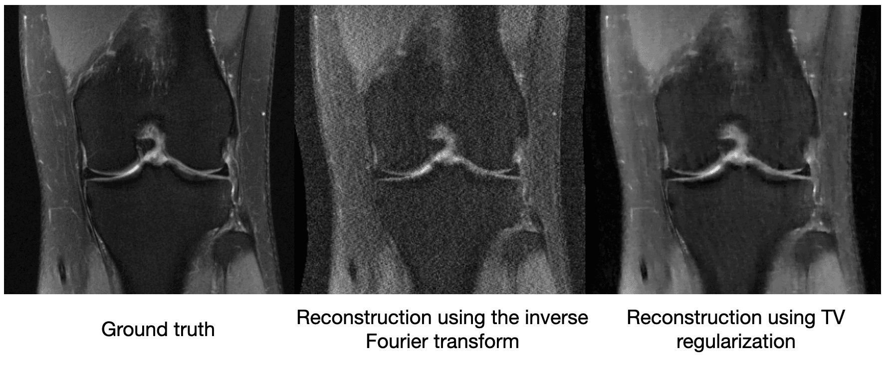 Compressed sensing comparison