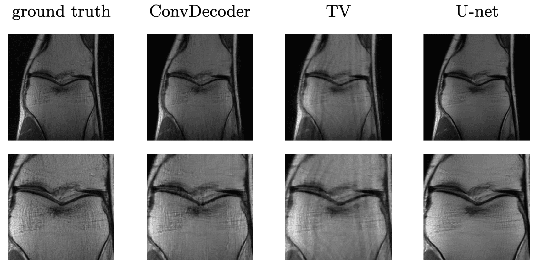 ConvDecoder results