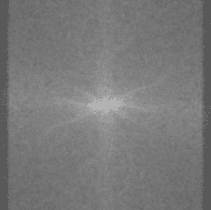 MRI sensor data