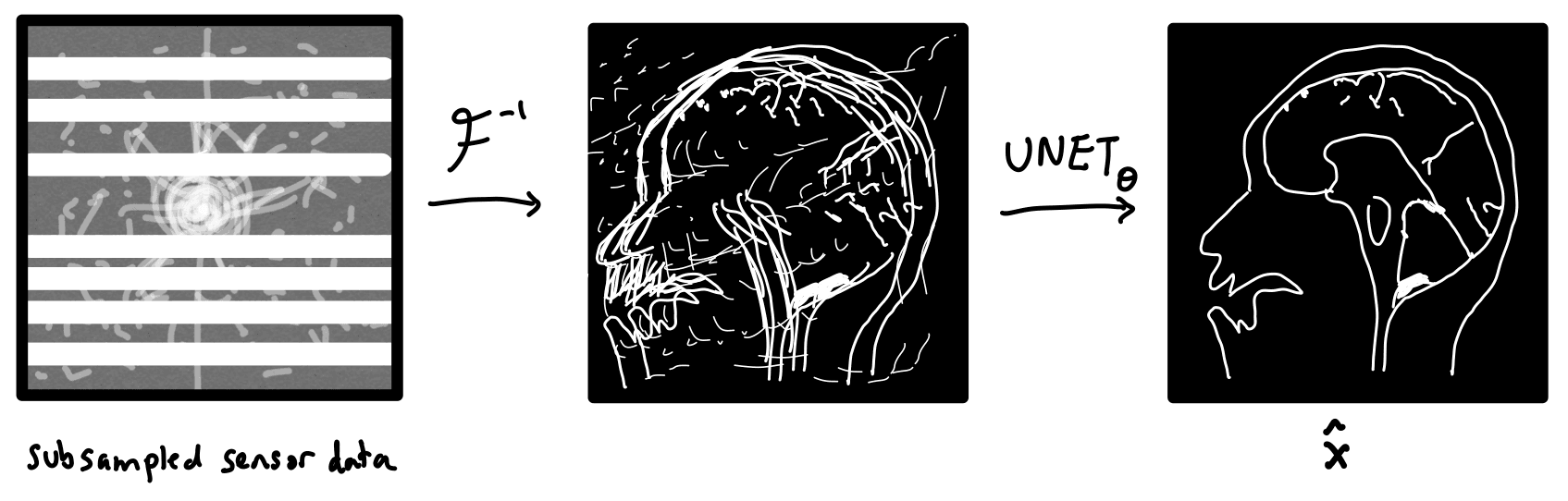 U-Net MRI diagram