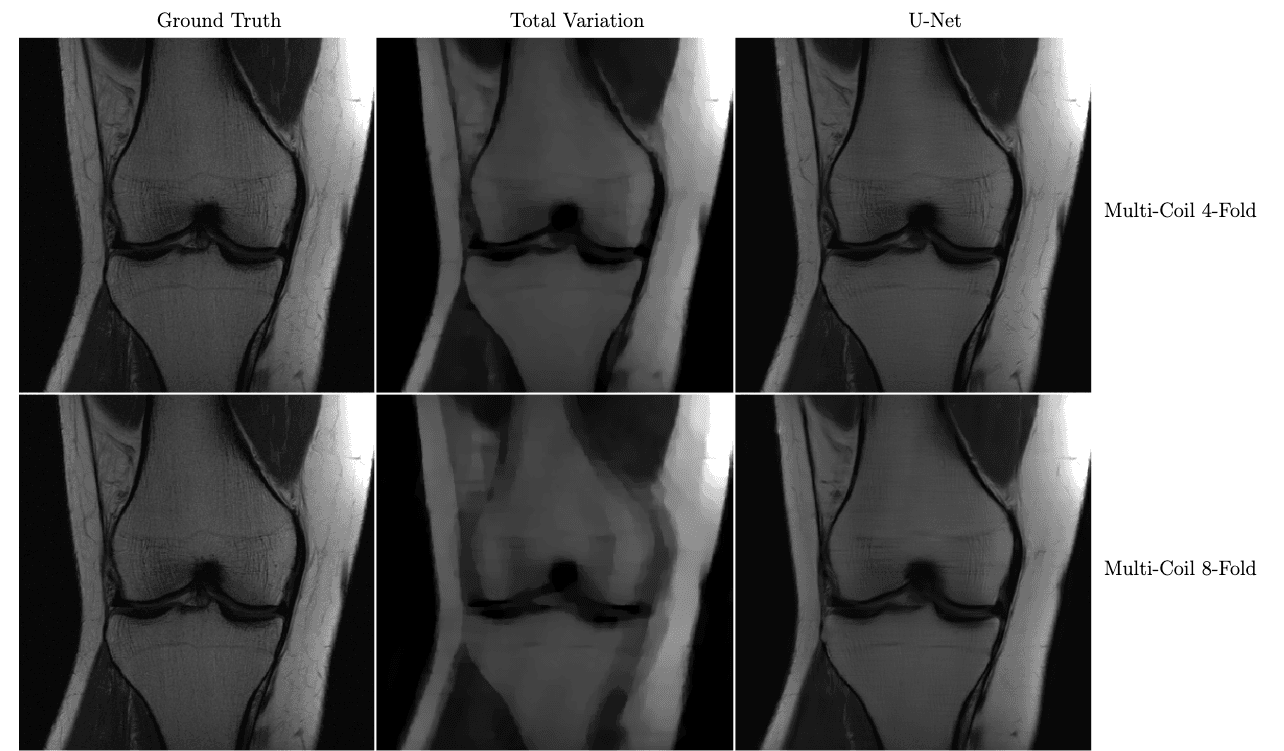 U-Net MRI results